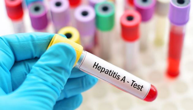 Вспышку гепатита А в Винницкой области объявили чрезвычайной ситуацией - Минздрав