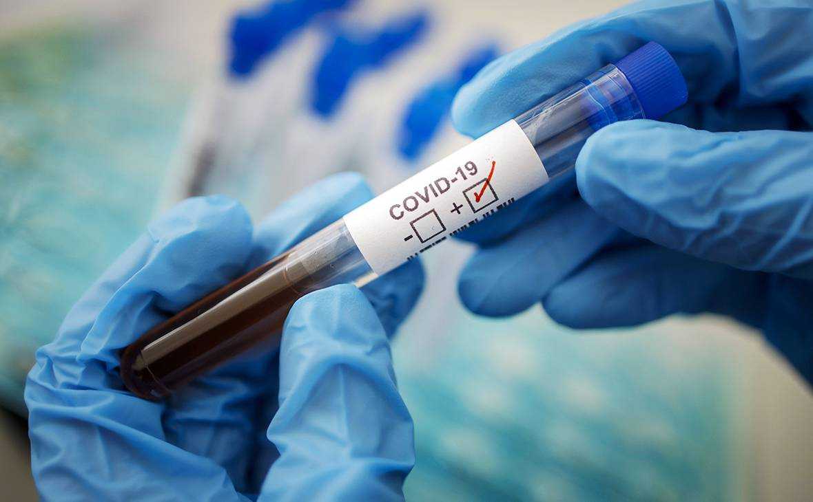 Тест на COVID-19: будут ли частные лаборатории бесплатно брать анализ