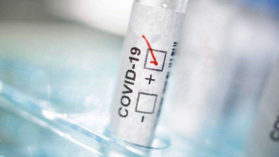 Вероятность смерти от COVID-19 можно определить по анализу крови - ученые