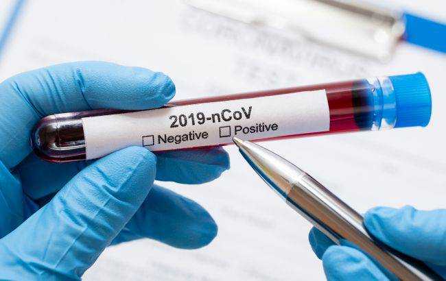 Изобретен "мгновенный" тест на коронавирус: когда появится в продаже