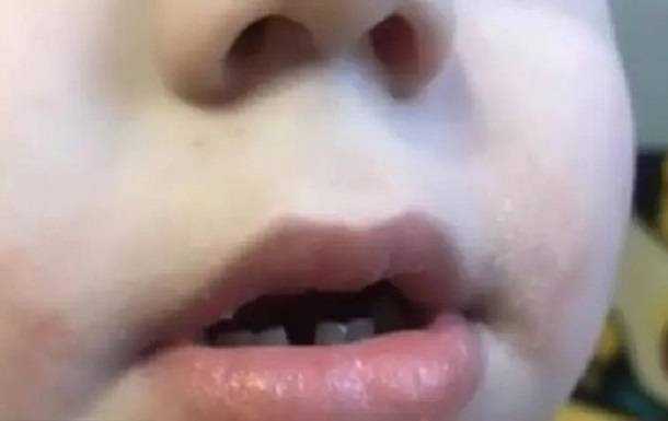 У дитсадку Луцька вихователь заклеїла дитині рот скотчем - ЗМІ