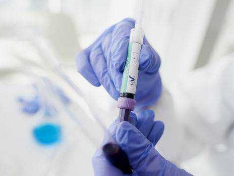 В Украине провели уже более 3 млн тестов на коронавирус - Ляшко