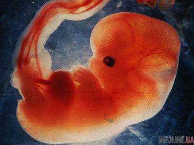 В Раде предложили разрешать женщинам делать аборт только в исключительных случаях