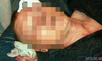 В Ровно азербайджанец жестоко избил бойца АТО