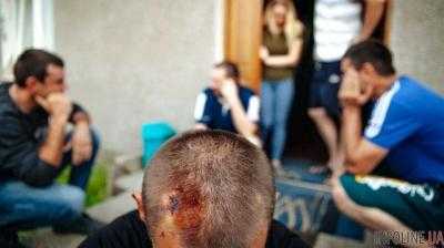«П***те в Украину! Домой, курва!»: заробитчанам отбили почки и порезали уши