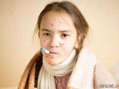 С начала года в Одесской области корью заболело почти 600 человек