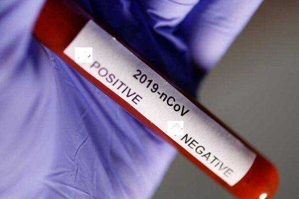 Испания вернула Китаю бракованные тесты на коронавирус