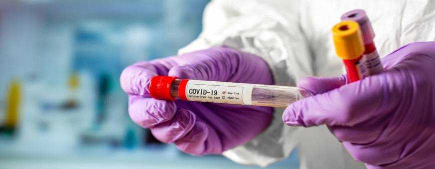 Украинцев будут массово проверять на коронавирус