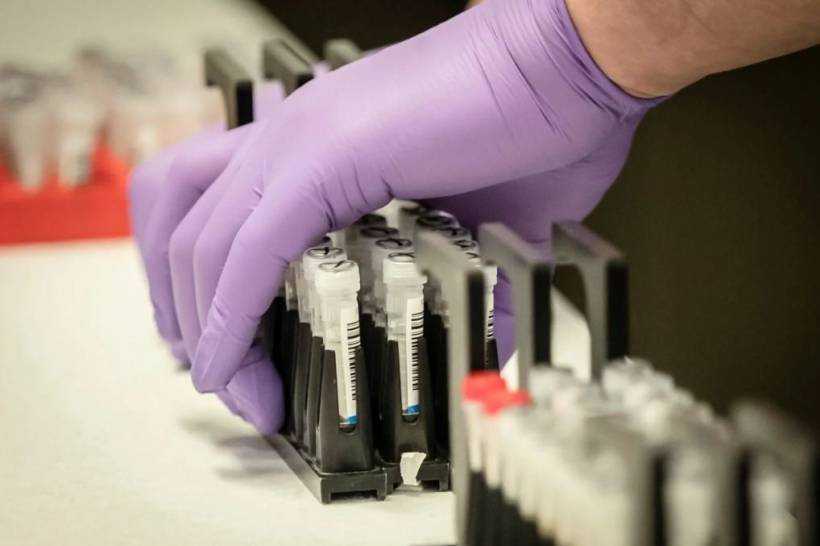 В Украине готовится массовое тестирование на антитела к коронавирусу: в МОЗ назвали сроки
