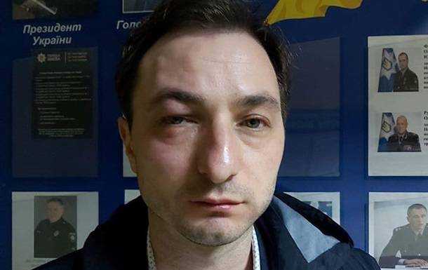 Главного врача Нацинститута рака избили в Киеве