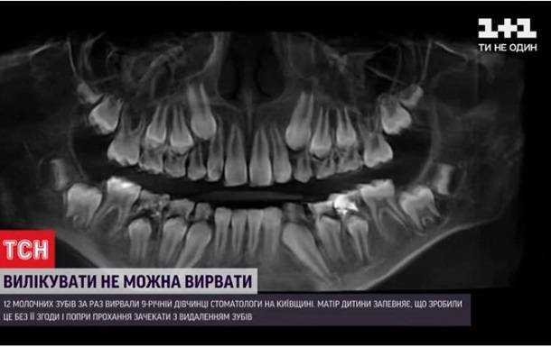 Під Києвом стоматолог видалив дитині 12 зубів без згоди батьків