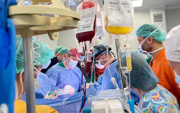В Украине впервые провели сплит-трансплантацию печени