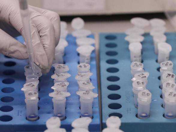 Зараженных намного больше, тесты не работают: врач скорой в Киеве рассказал об ужасах борьбы с коронавирусом