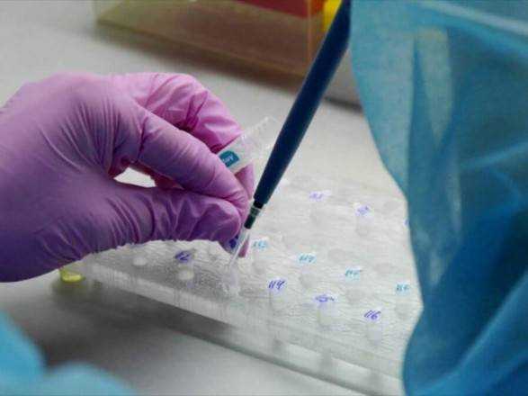 Украина разработала тест-системы обнаружения коронавируса на ранней стадии заражения