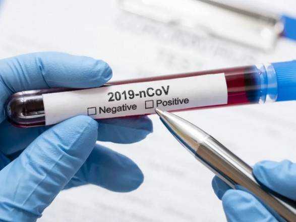 В Запорожье начали проводить тесты на иммунитет к COVID-19