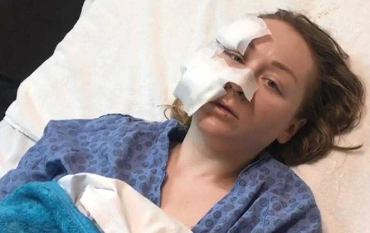 В турецком ТЦ муж порезал лицо 28-летней украинке