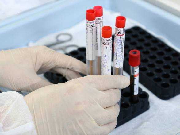 Украинский тесты на антиген планируют запустить в промышленное производство за две недели