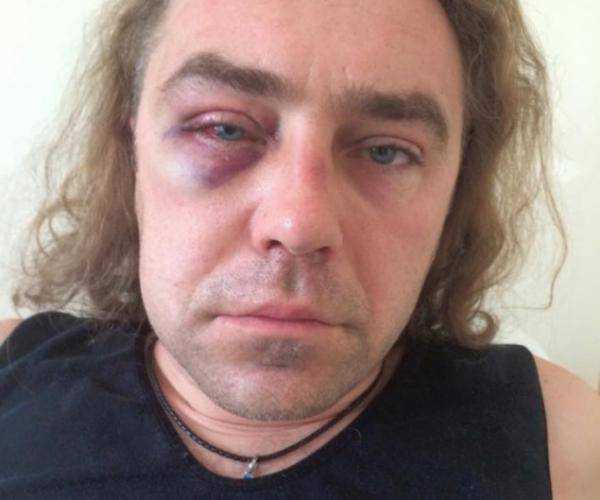 В Киеве избили экс-нардепа от "Свободы"  Игоря Мирошниченко