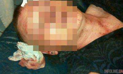 В Бердянске местный житель сильно избил бойца ООС