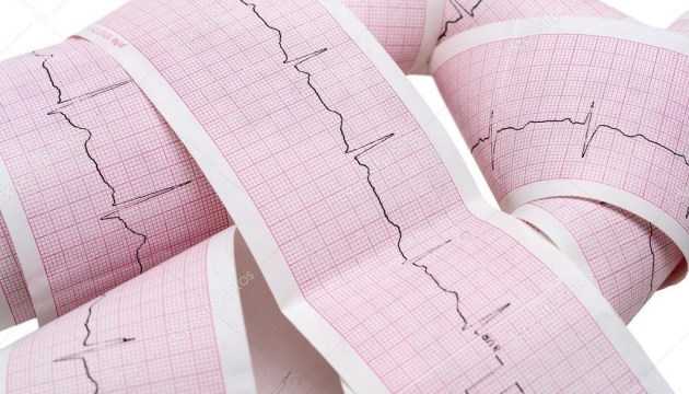 Как распознать признаки «тихого» инфаркта миокарда
