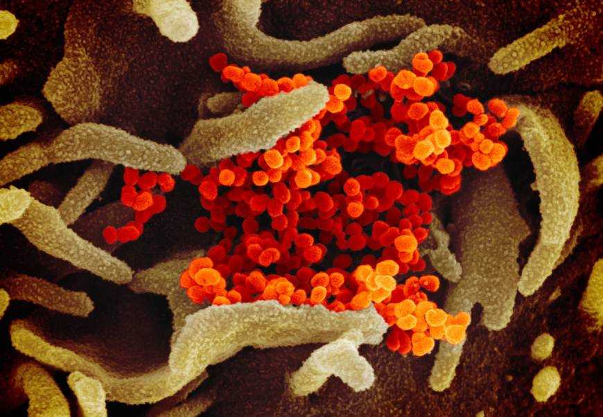 как выглядит смертельная болезнь под микроскопом: коронавирус COVID-19