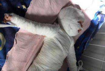 На Херсонщине 8-месячный малыш искупался в кипятке