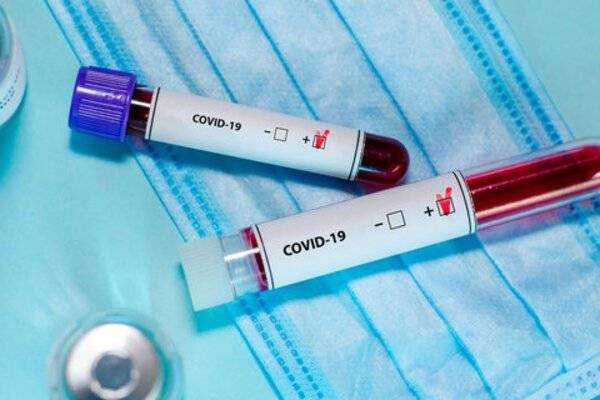 Как пройти тест на коронавирус при отказе врача