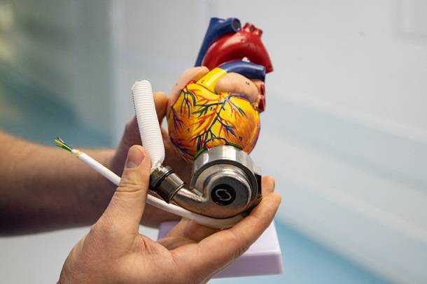 В больнице Киева впервые имплантировали механическое сердце