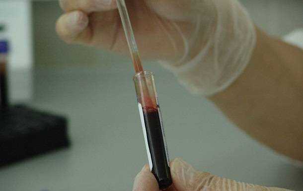 В Індії у хворого на коронавірус витягли довгий кров'яний тромб