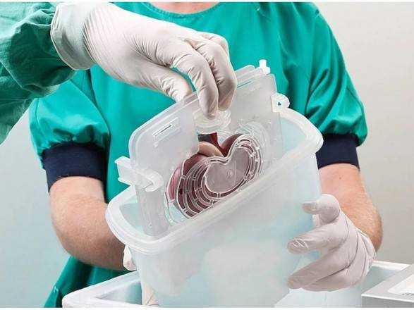 В Минздраве рассказали, что мешает увеличить количество трансплантаций органов