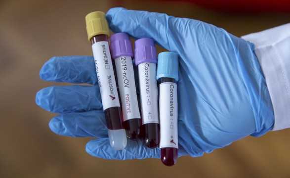 В Черновицкой области обнаружили еще 5 больных коронавирусом: среди них 2-летний ребенок